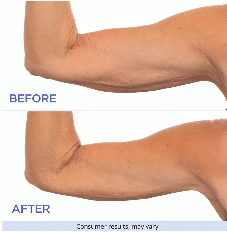 FIRMA™ All In One - Sculpt & Tone Cream